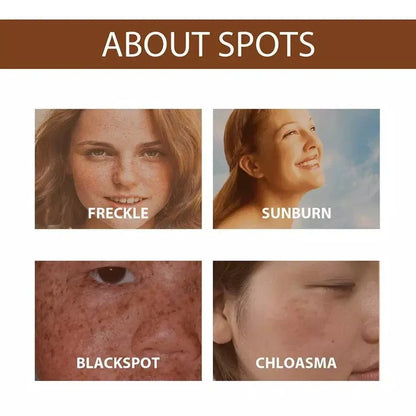 ZA7 Anti Freckle Serum
